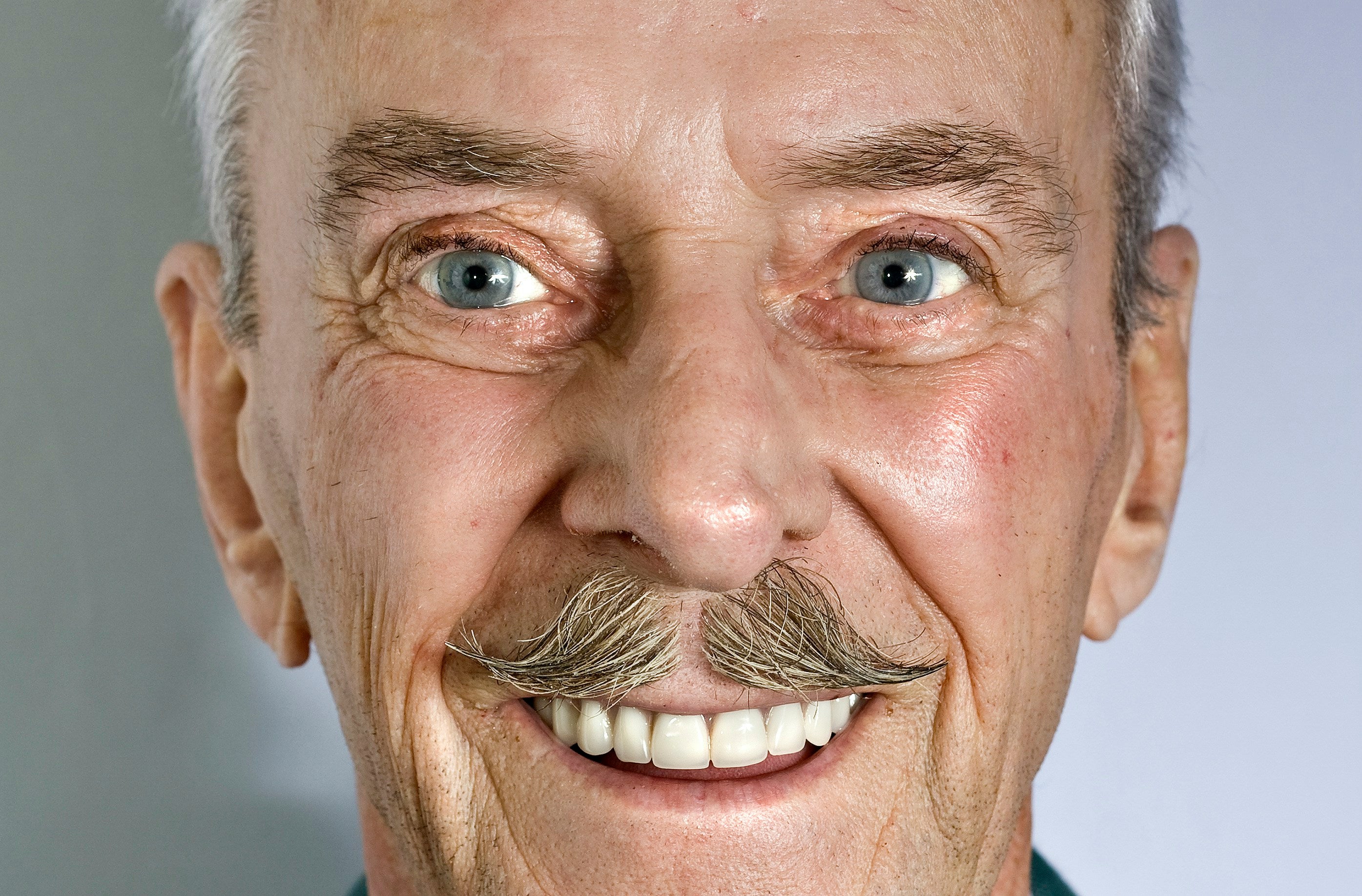 Alidon's Guide to Understanding Root Canal Procedures